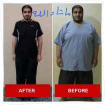 obesity-before-after